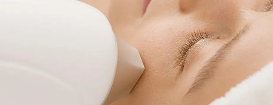 Fotona 4D Nonsurgical Facelift Fotona
