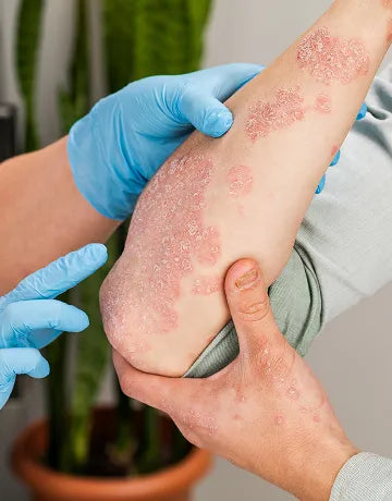 Prime Dermatology — patient experience
